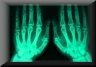X-Ray Film!
